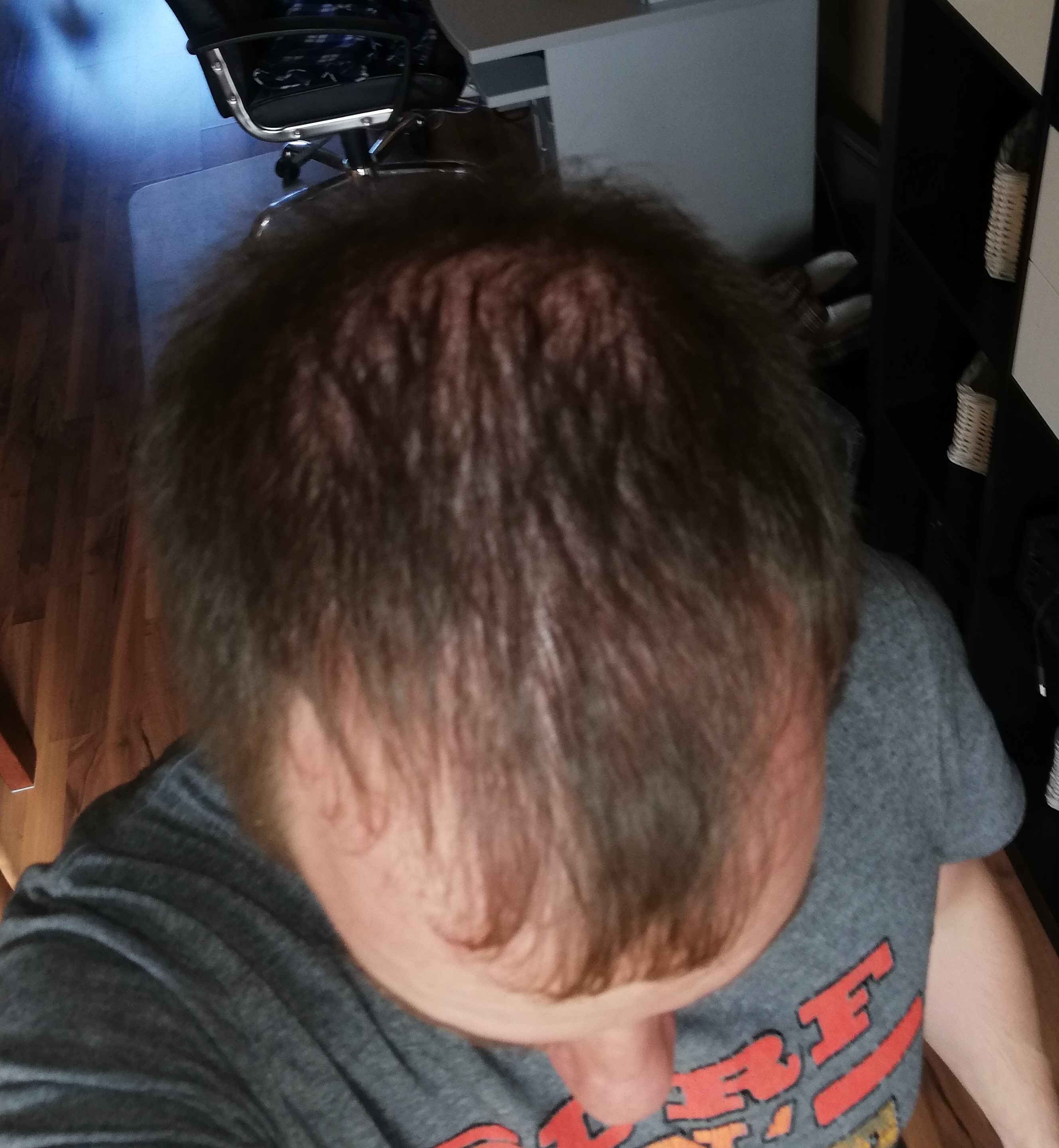 /foren/transplant/index.php?t=getfile&id=43571&private=0