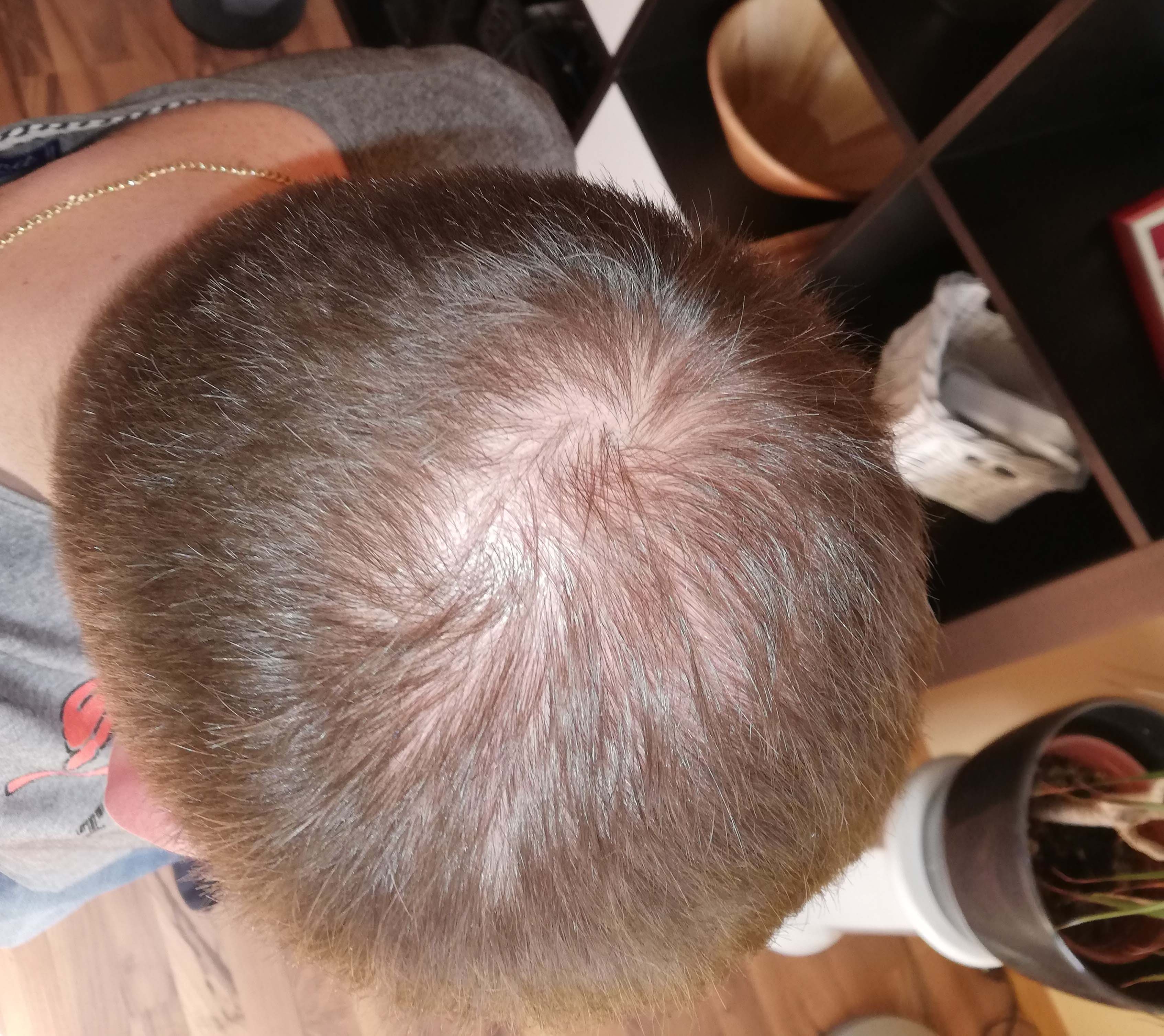 /foren/transplant/index.php?t=getfile&id=43572&private=0