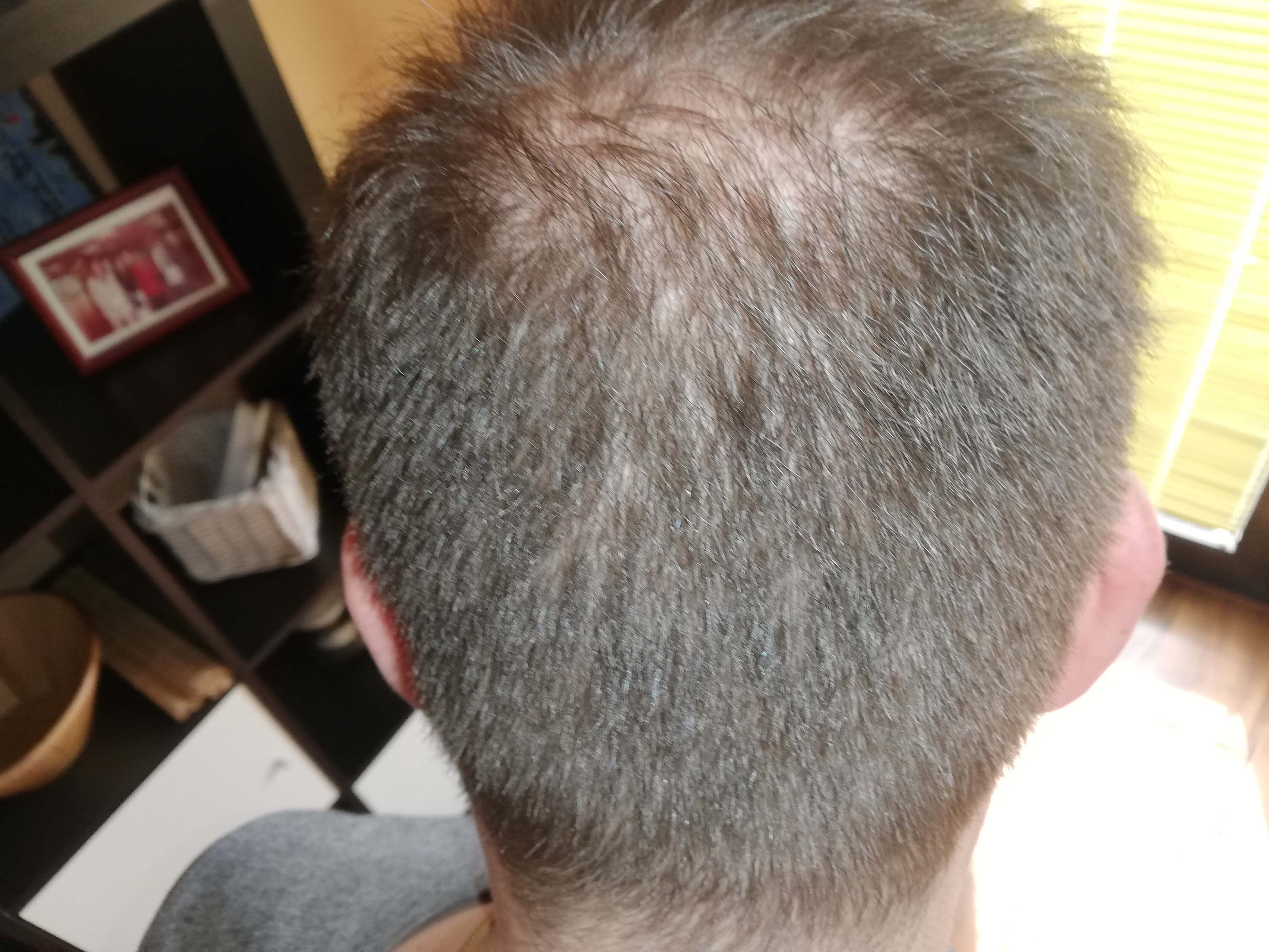 /foren/transplant/index.php?t=getfile&id=43573&private=0