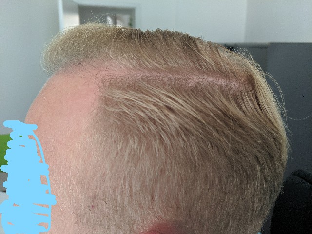 /foren/transplant/index.php?t=getfile&id=43583&private=0