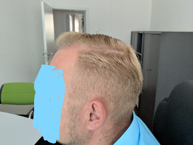 /foren/transplant/index.php?t=getfile&id=43584&private=0