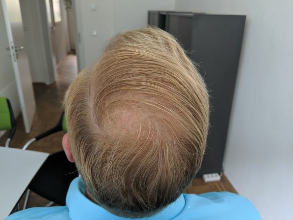 /foren/transplant/index.php?t=getfile&id=43586&private=0