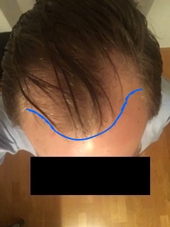 /foren/transplant/index.php?t=getfile&id=43702&private=0