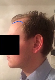 /foren/transplant/index.php?t=getfile&id=43703&private=0