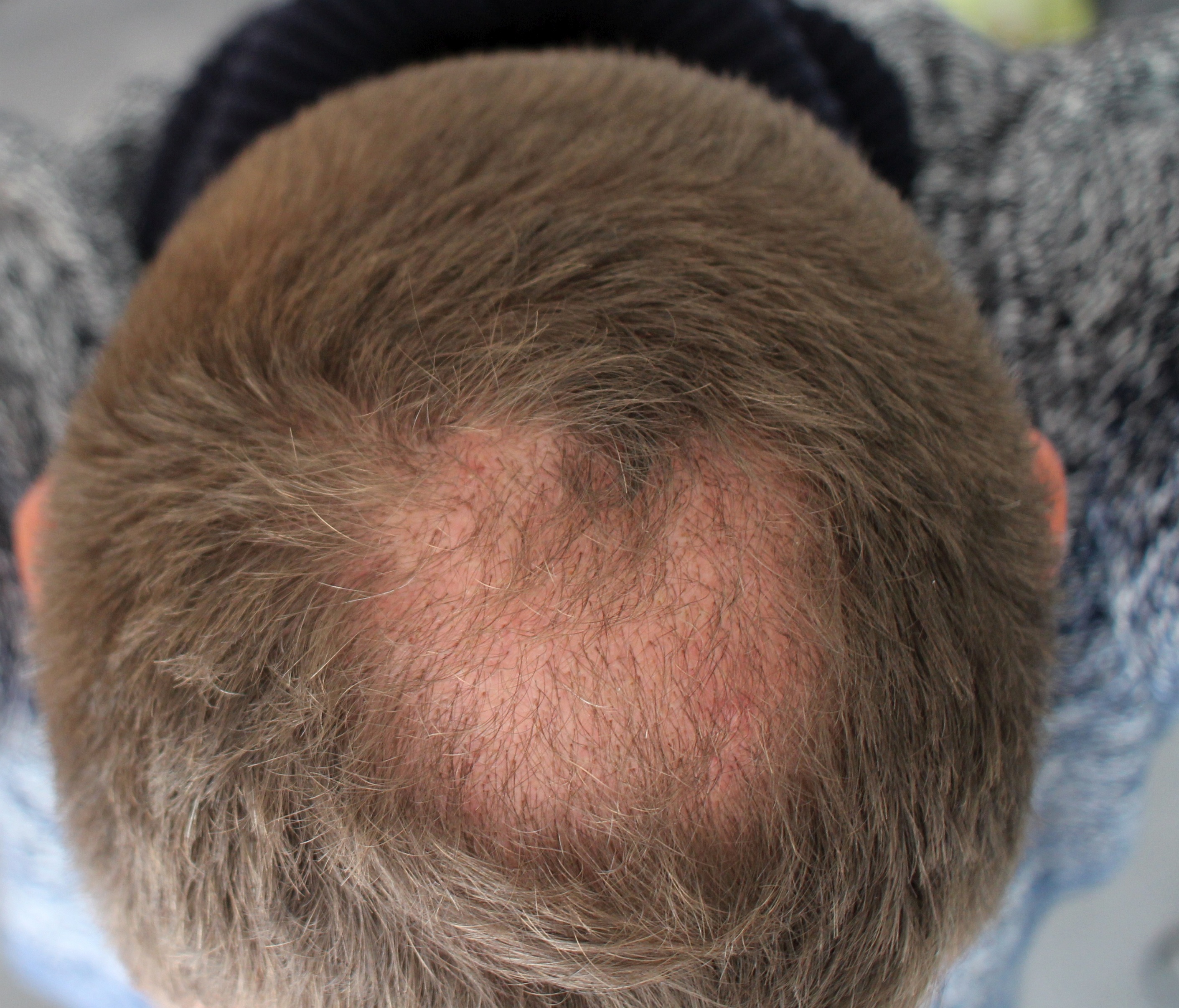 /foren/transplant/index.php?t=getfile&id=43830&private=0