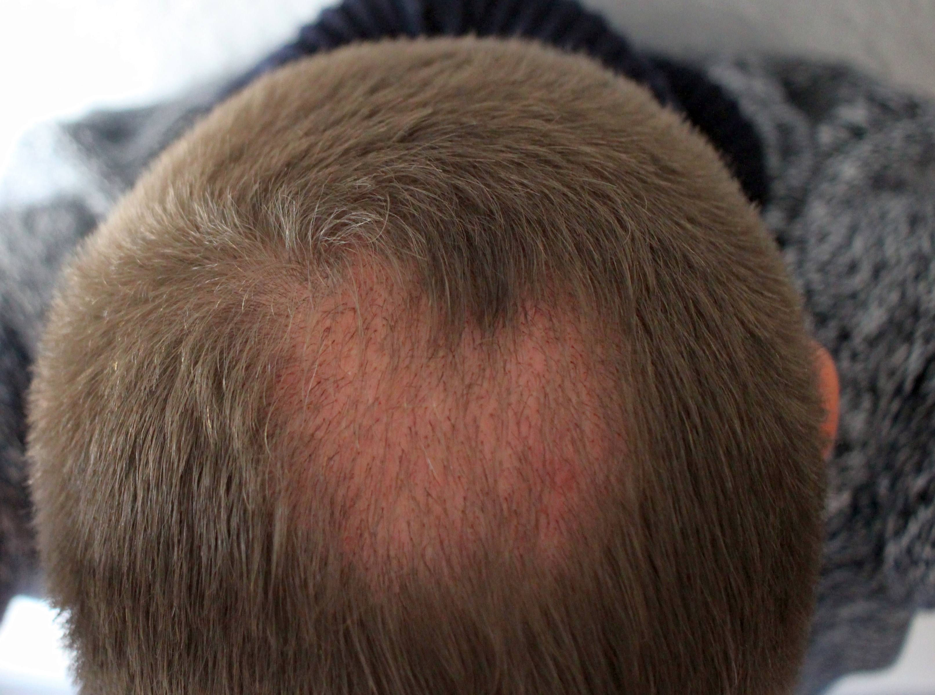 /foren/transplant/index.php?t=getfile&id=43831&private=0