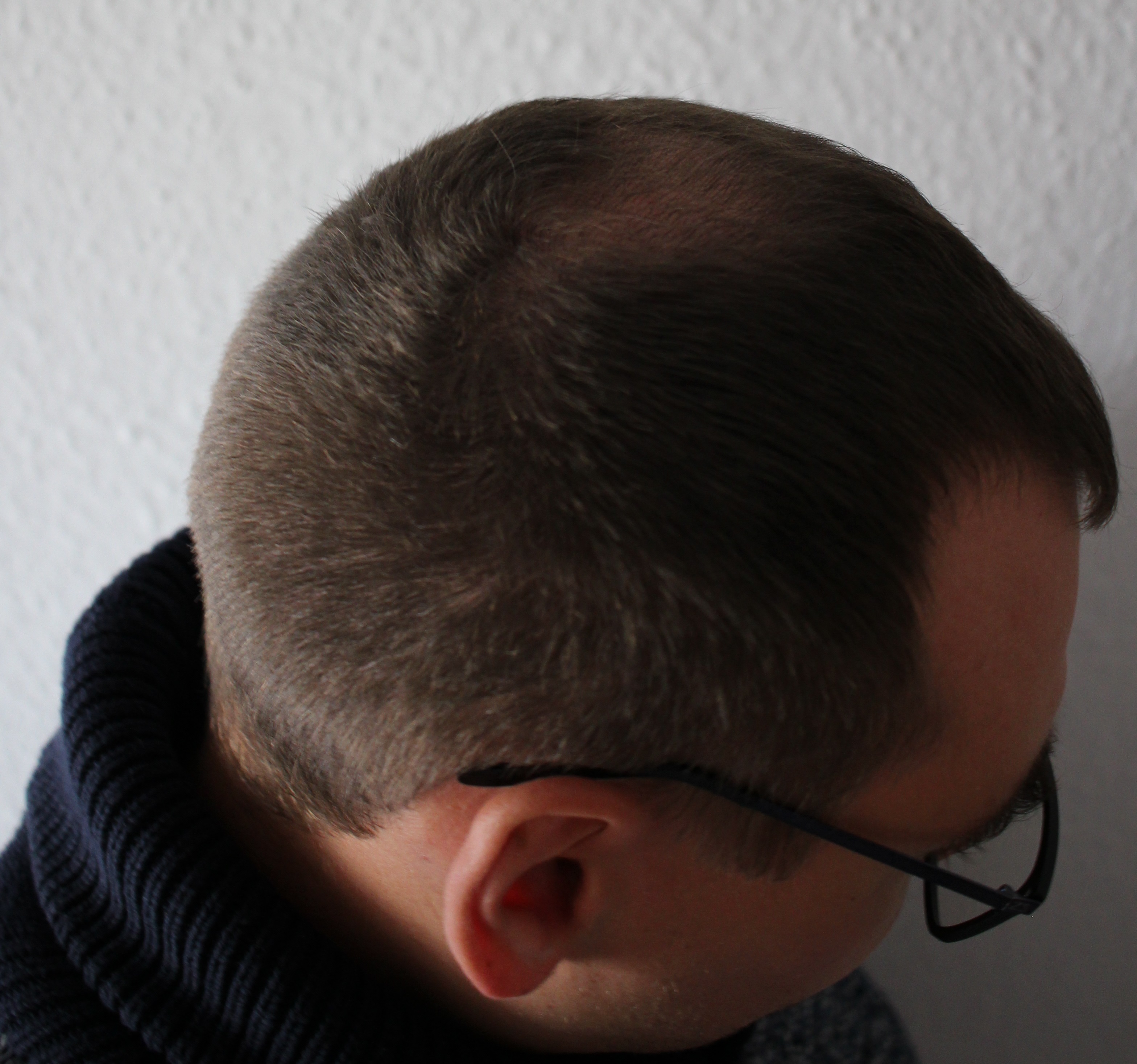 /foren/transplant/index.php?t=getfile&id=43832&private=0