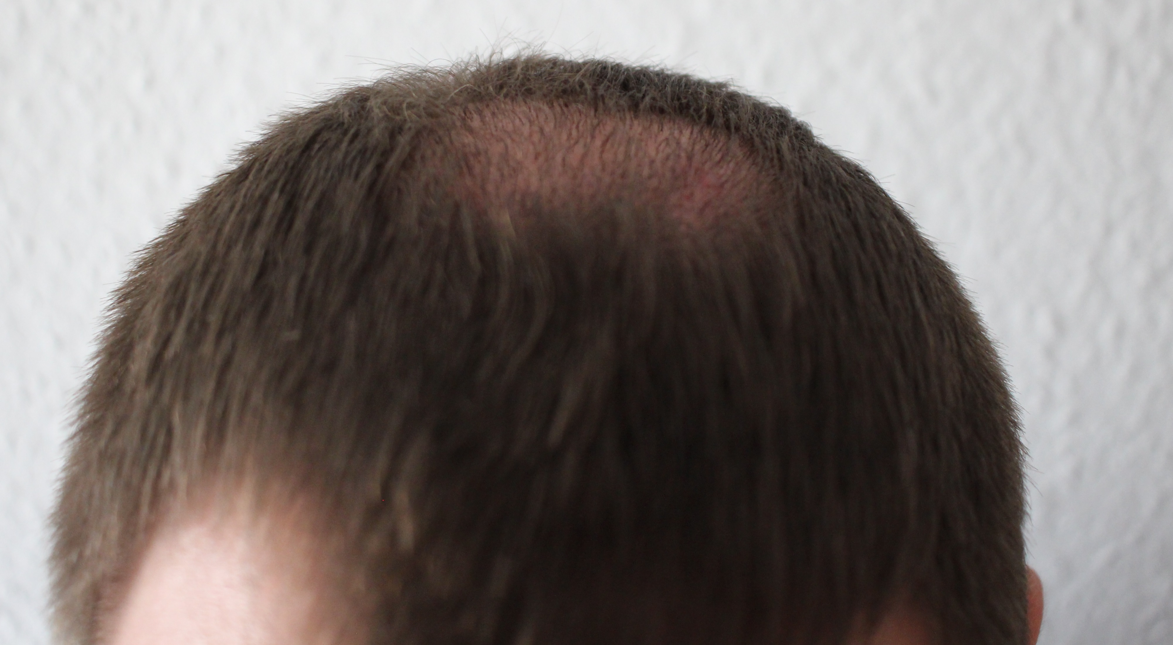 /foren/transplant/index.php?t=getfile&id=43833&private=0