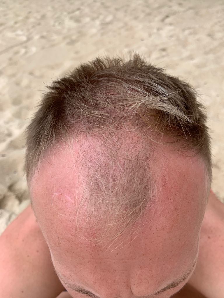 /foren/transplant/index.php?t=getfile&id=43851&private=0