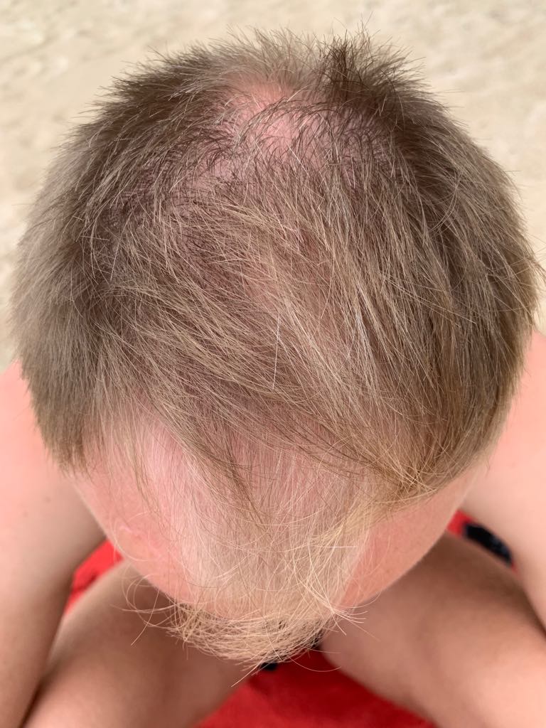 /foren/transplant/index.php?t=getfile&id=43852&private=0