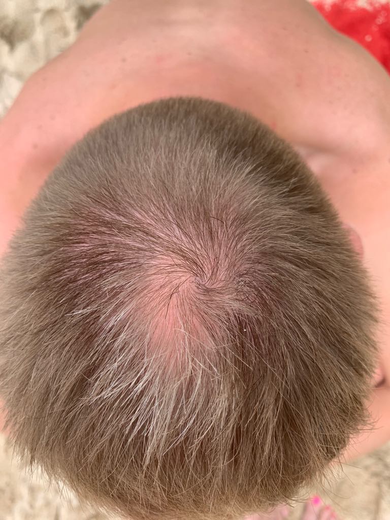 /foren/transplant/index.php?t=getfile&id=43853&private=0