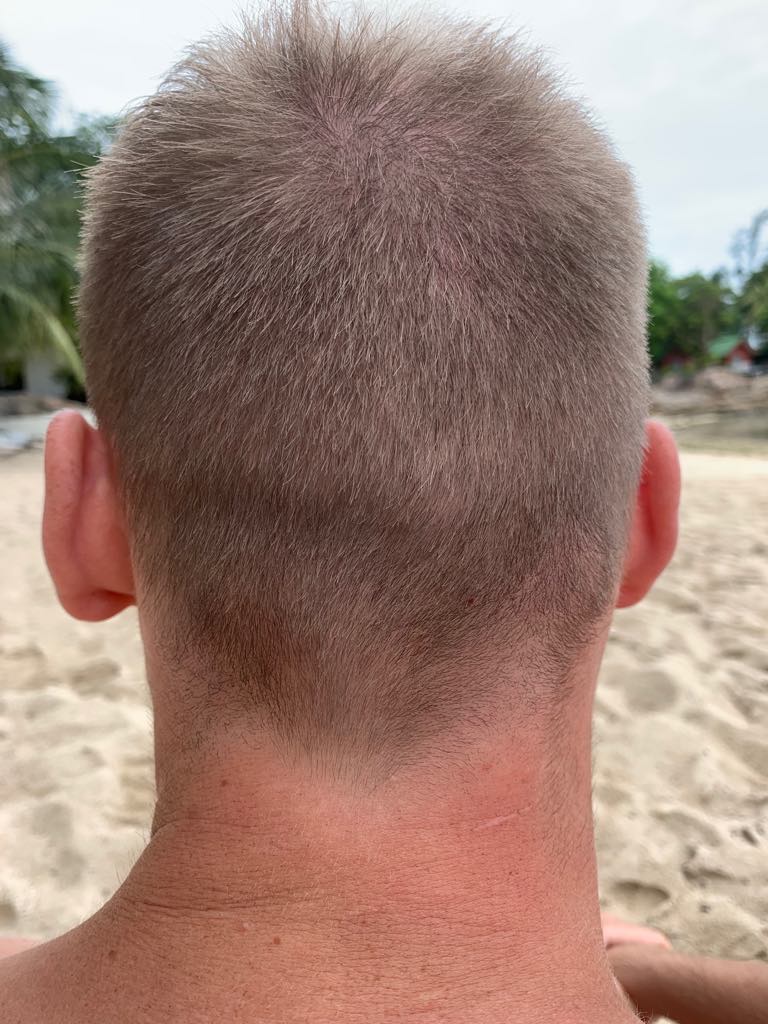 /foren/transplant/index.php?t=getfile&id=43854&private=0