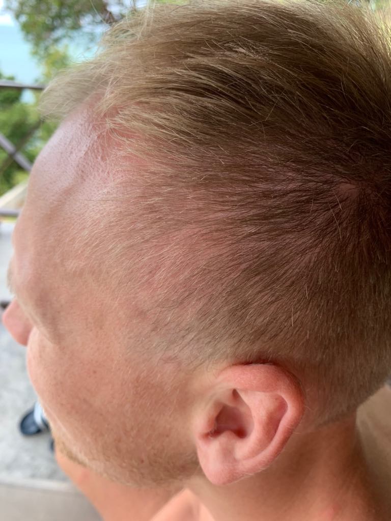 /foren/transplant/index.php?t=getfile&id=43855&private=0