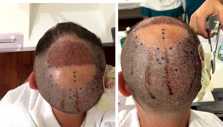 /foren/transplant/index.php?t=getfile&id=43871&private=0