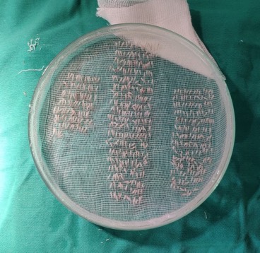 /foren/transplant/index.php?t=getfile&id=43872&private=0