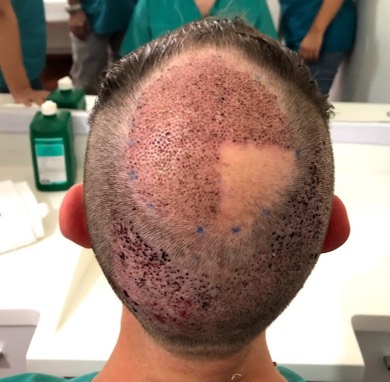 /foren/transplant/index.php?t=getfile&id=43873&private=0