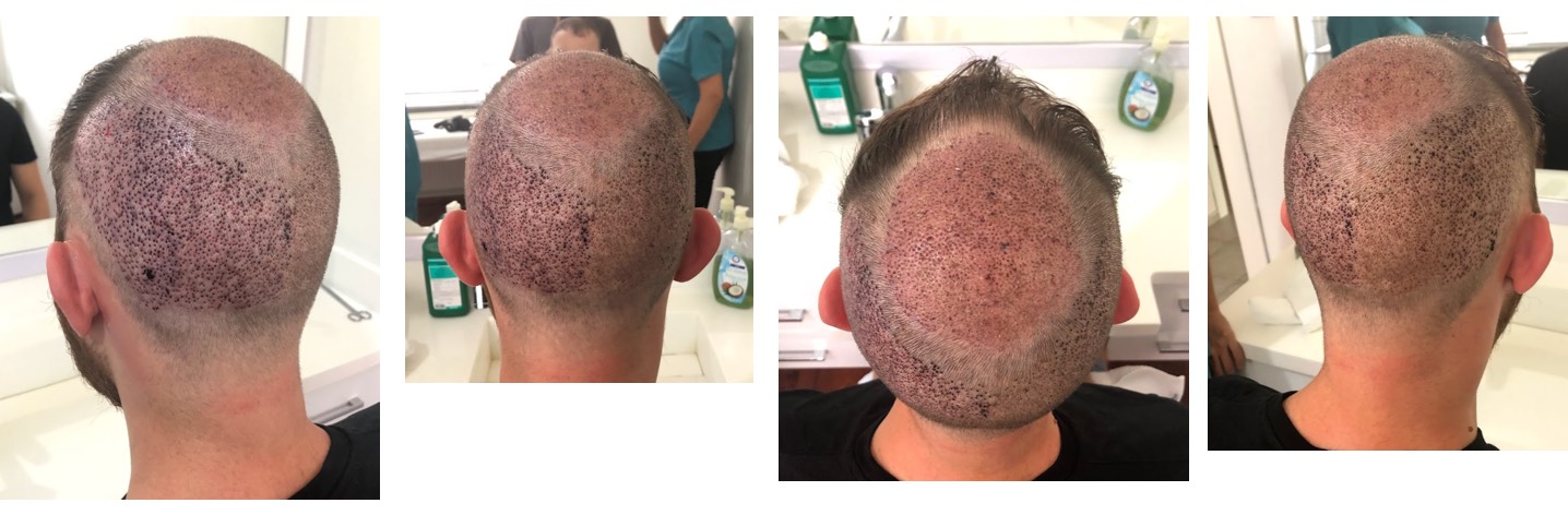 /foren/transplant/index.php?t=getfile&id=43874&private=0