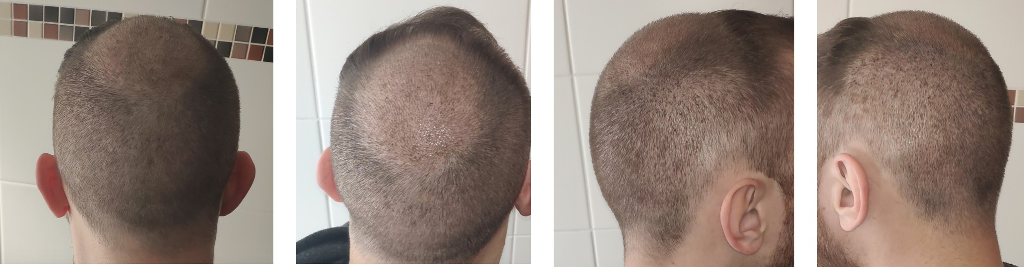 /foren/transplant/index.php?t=getfile&id=43876&private=0