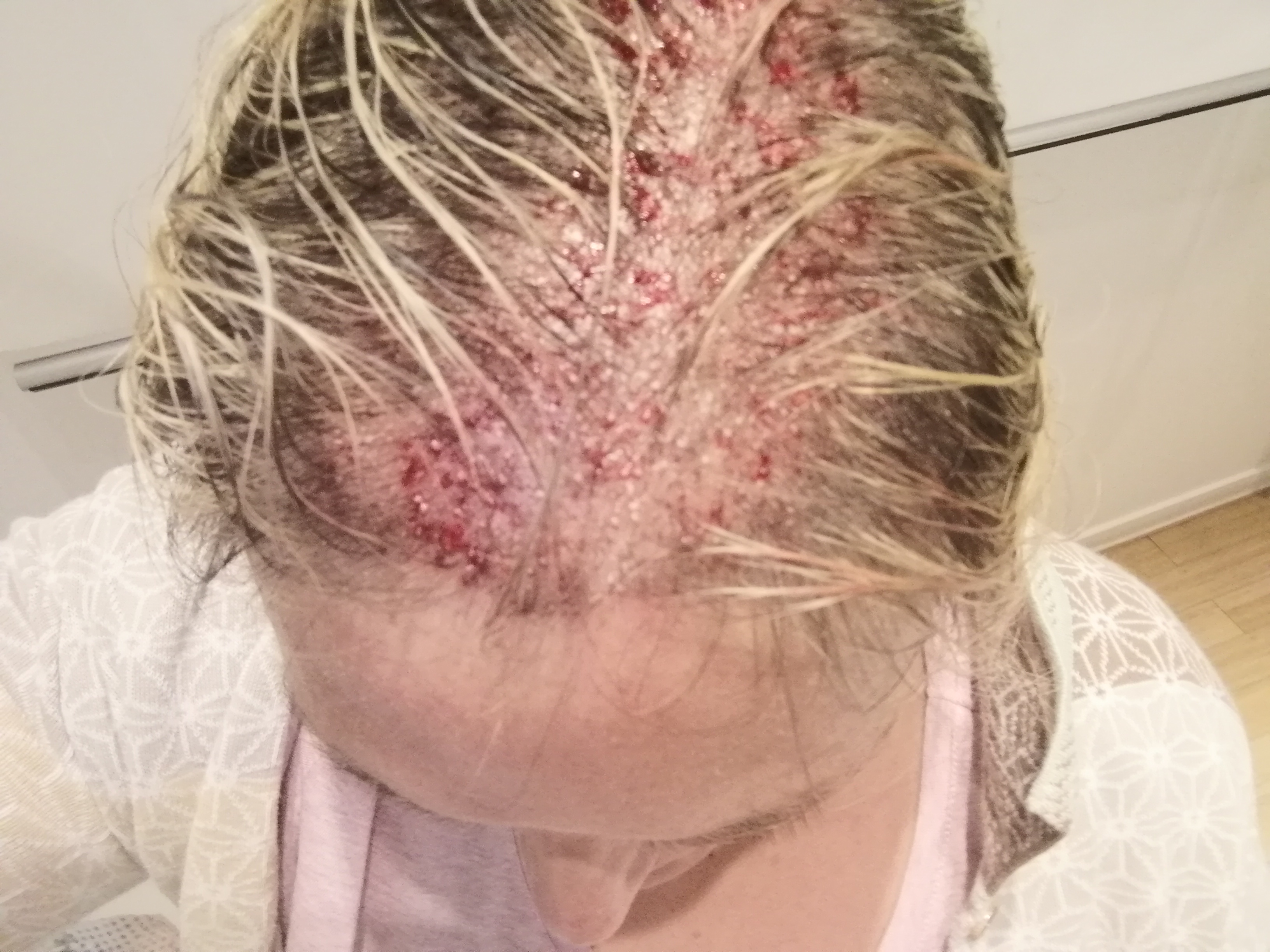 /foren/transplant/index.php?t=getfile&id=43945&private=0