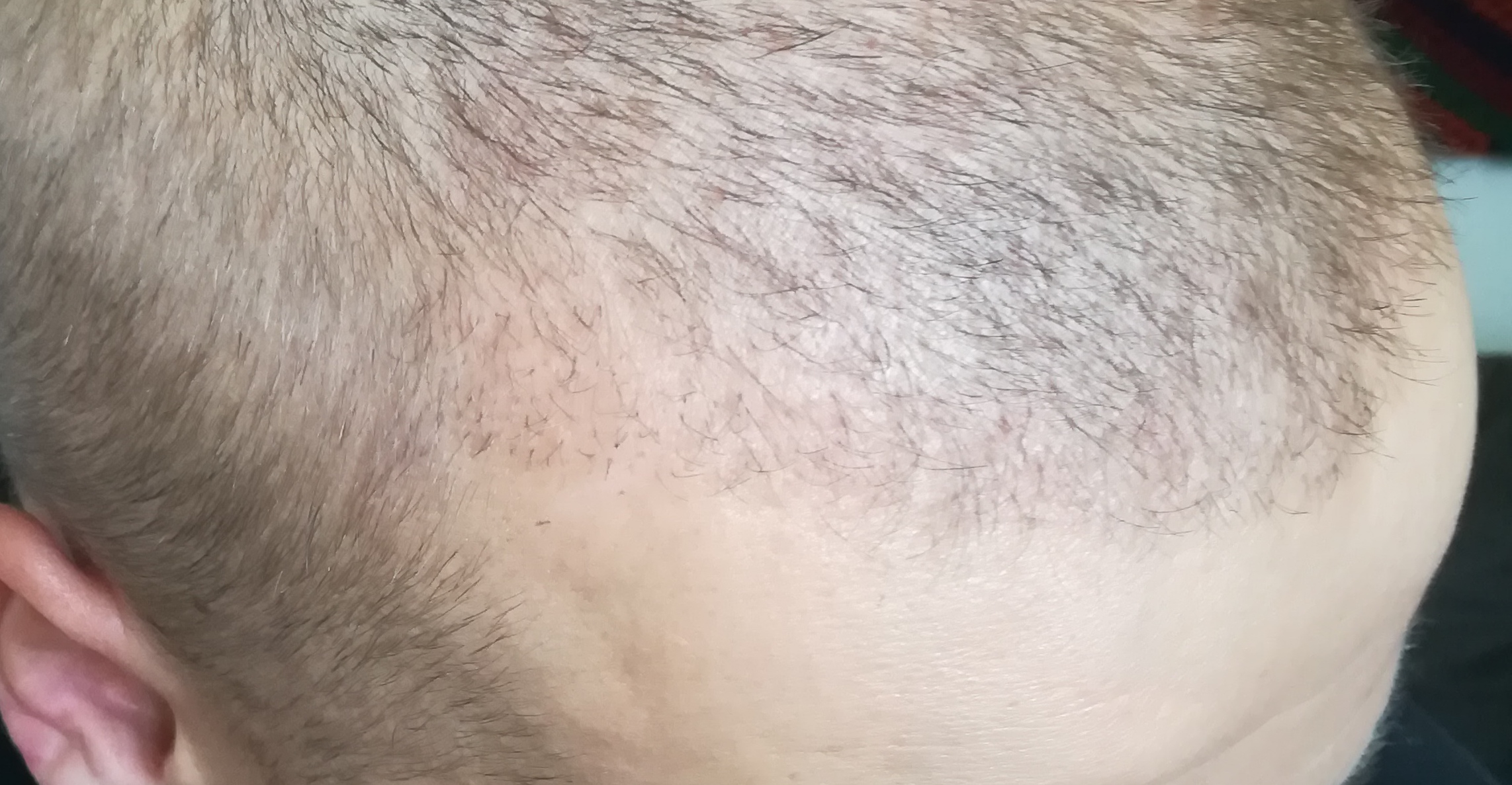 /foren/transplant/index.php?t=getfile&id=44171&private=0