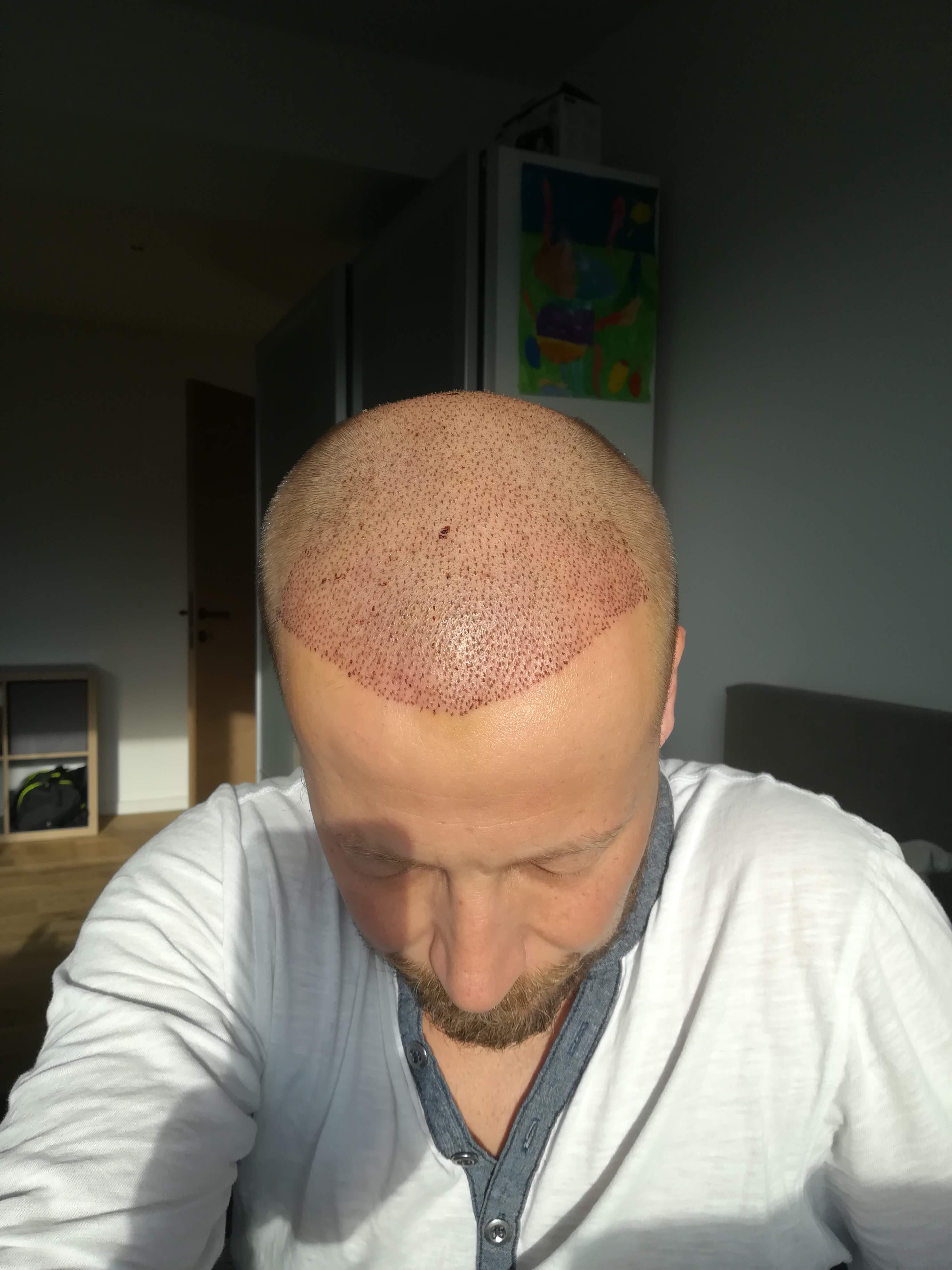 /foren/transplant/index.php?t=getfile&id=44176&private=0