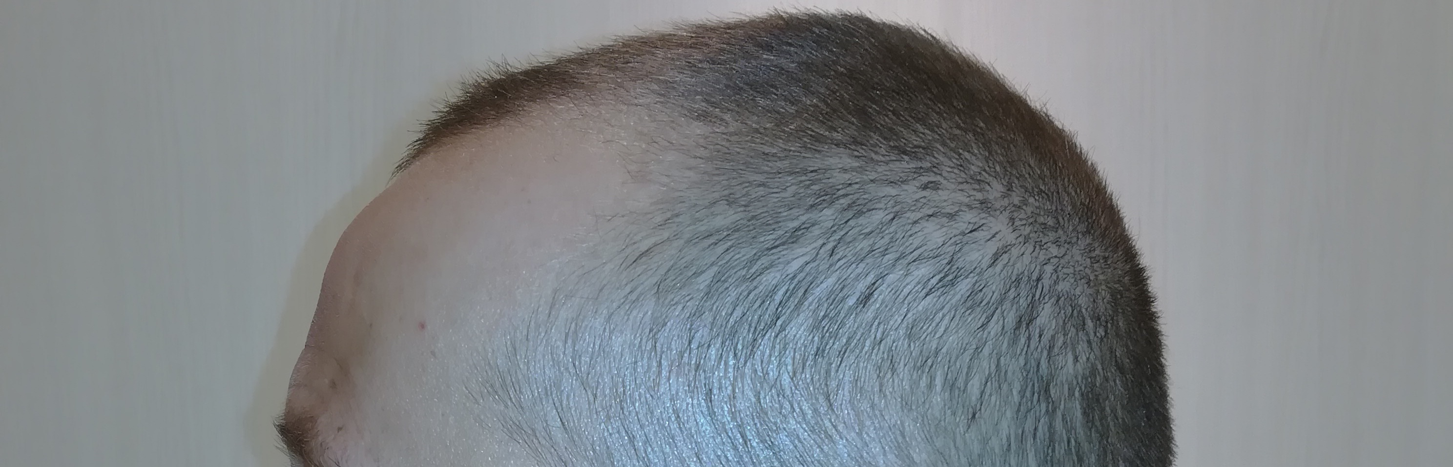 /foren/transplant/index.php?t=getfile&id=44177&private=0