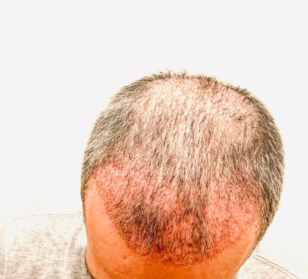 /foren/transplant/index.php?t=getfile&id=44678&private=0