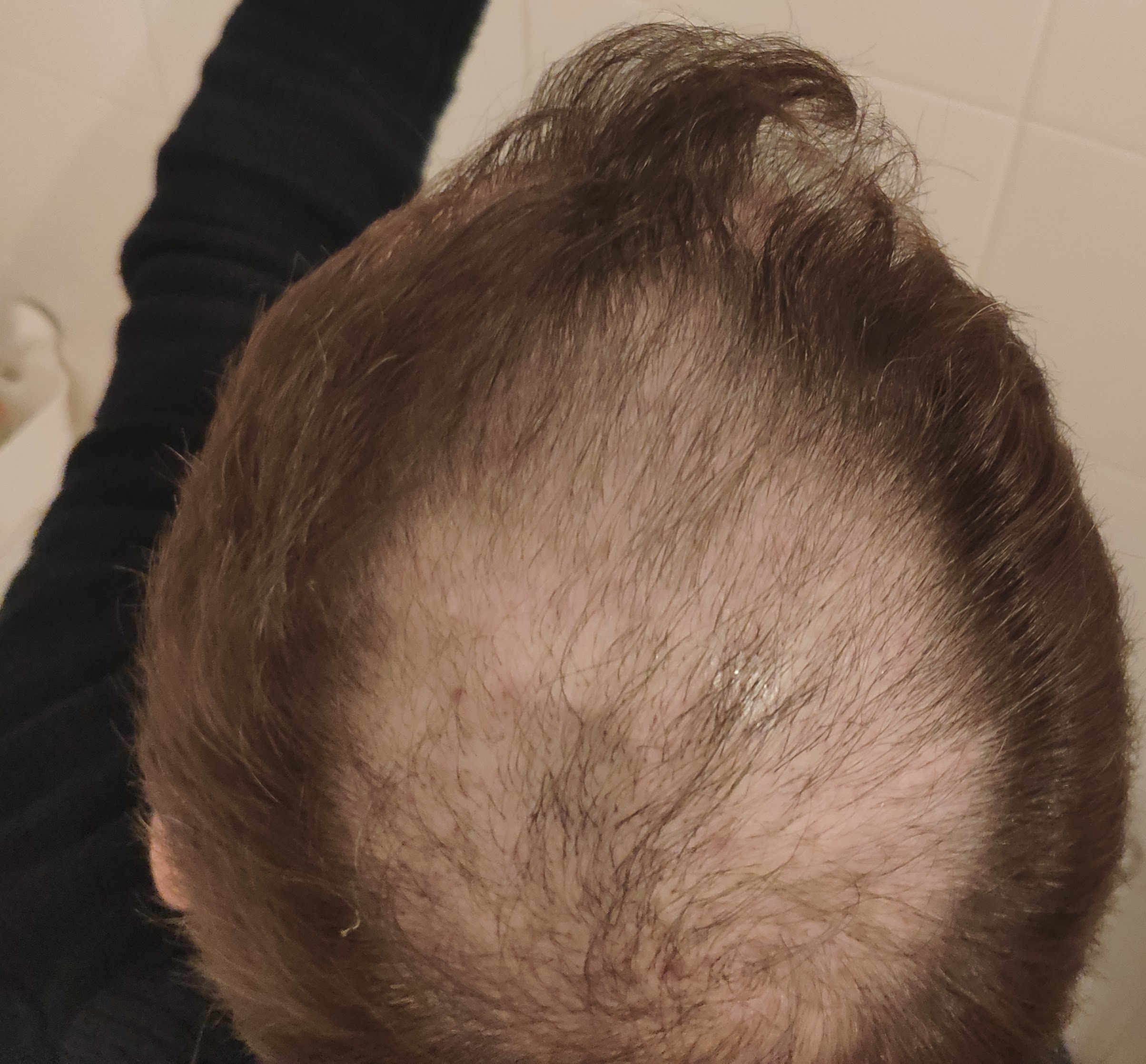 /foren/transplant/index.php?t=getfile&id=44834&private=0