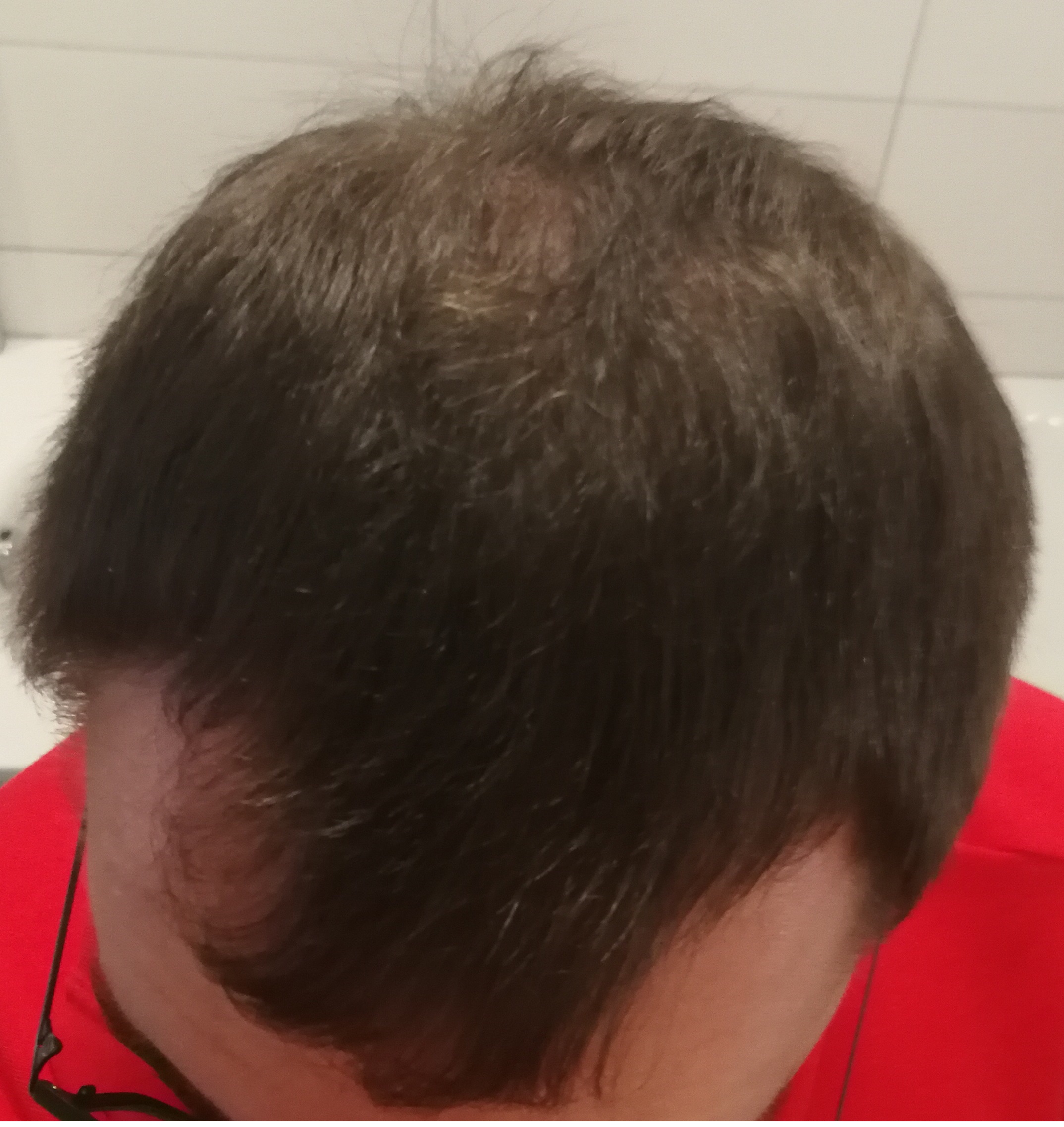 /foren/transplant/index.php?t=getfile&id=44867&private=0