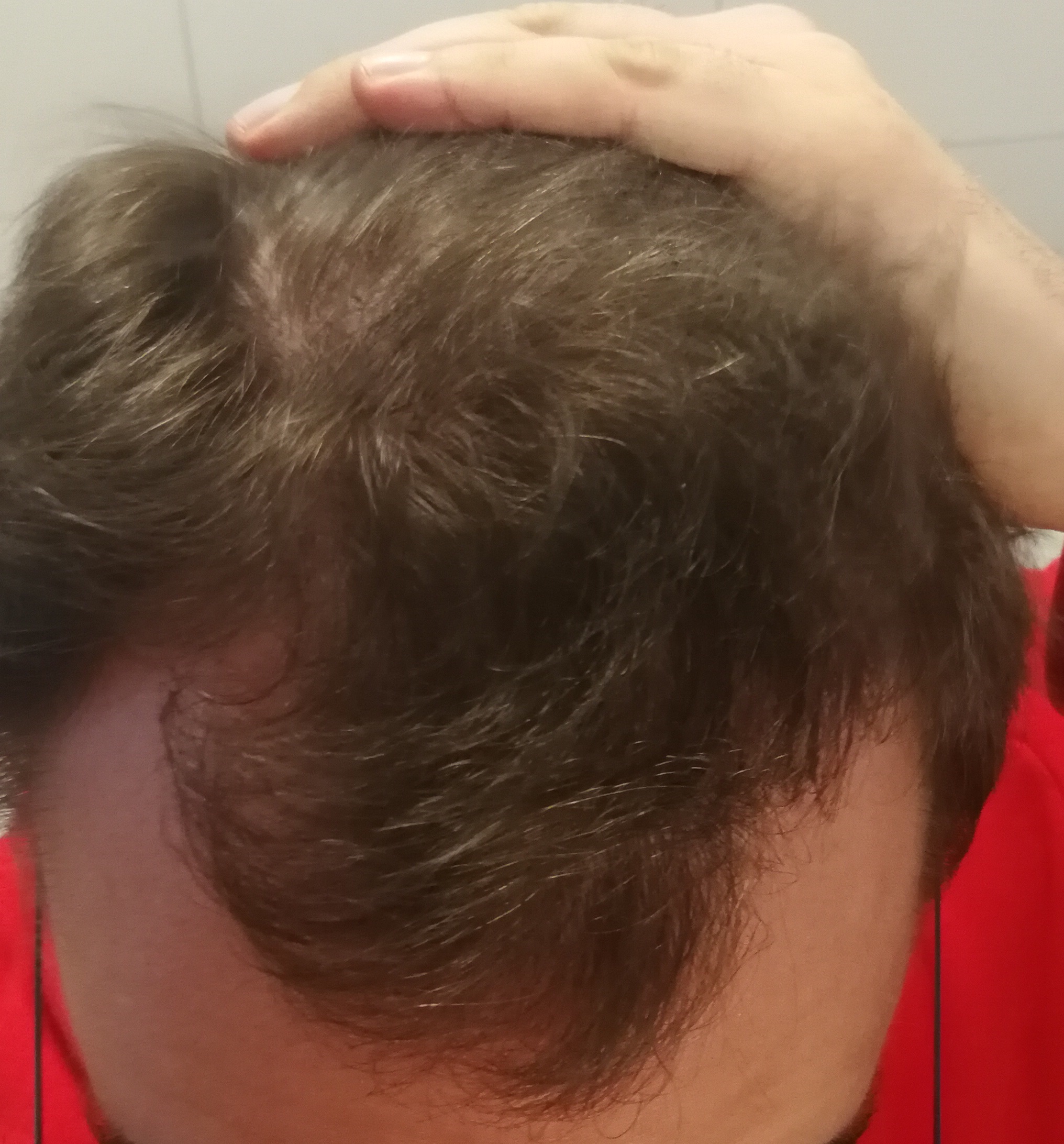 /foren/transplant/index.php?t=getfile&id=44868&private=0