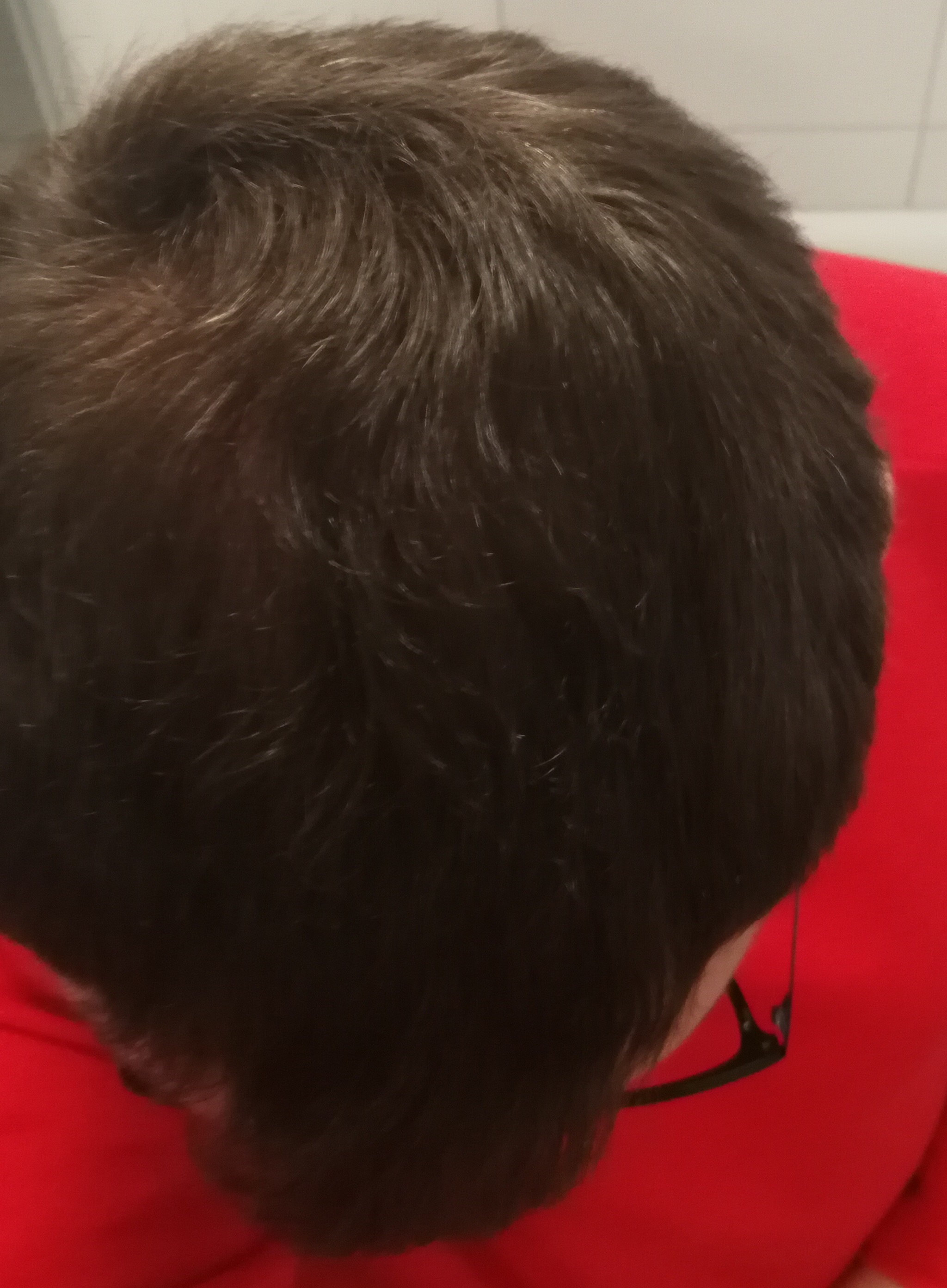 /foren/transplant/index.php?t=getfile&id=44869&private=0