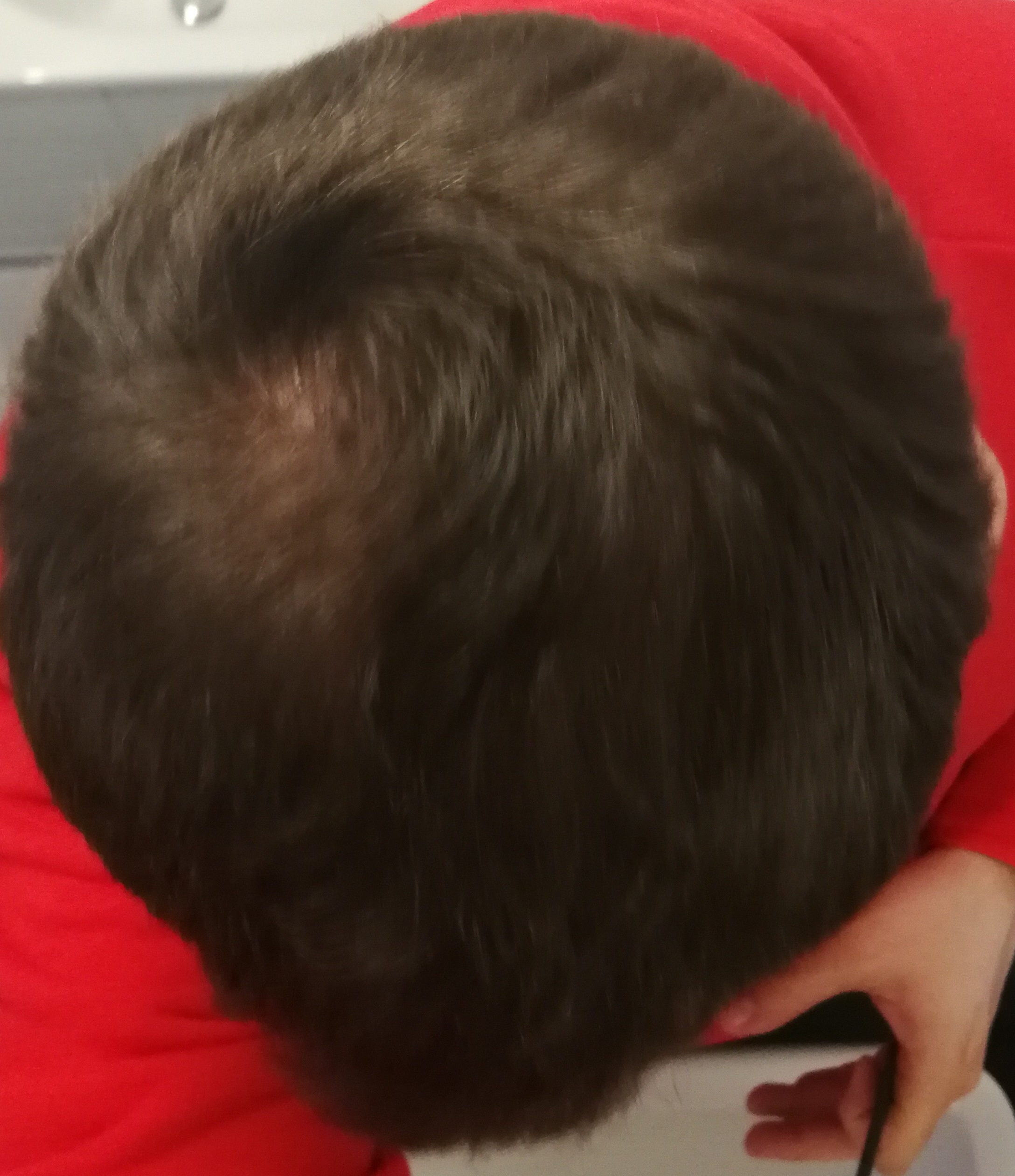 /foren/transplant/index.php?t=getfile&id=44870&private=0