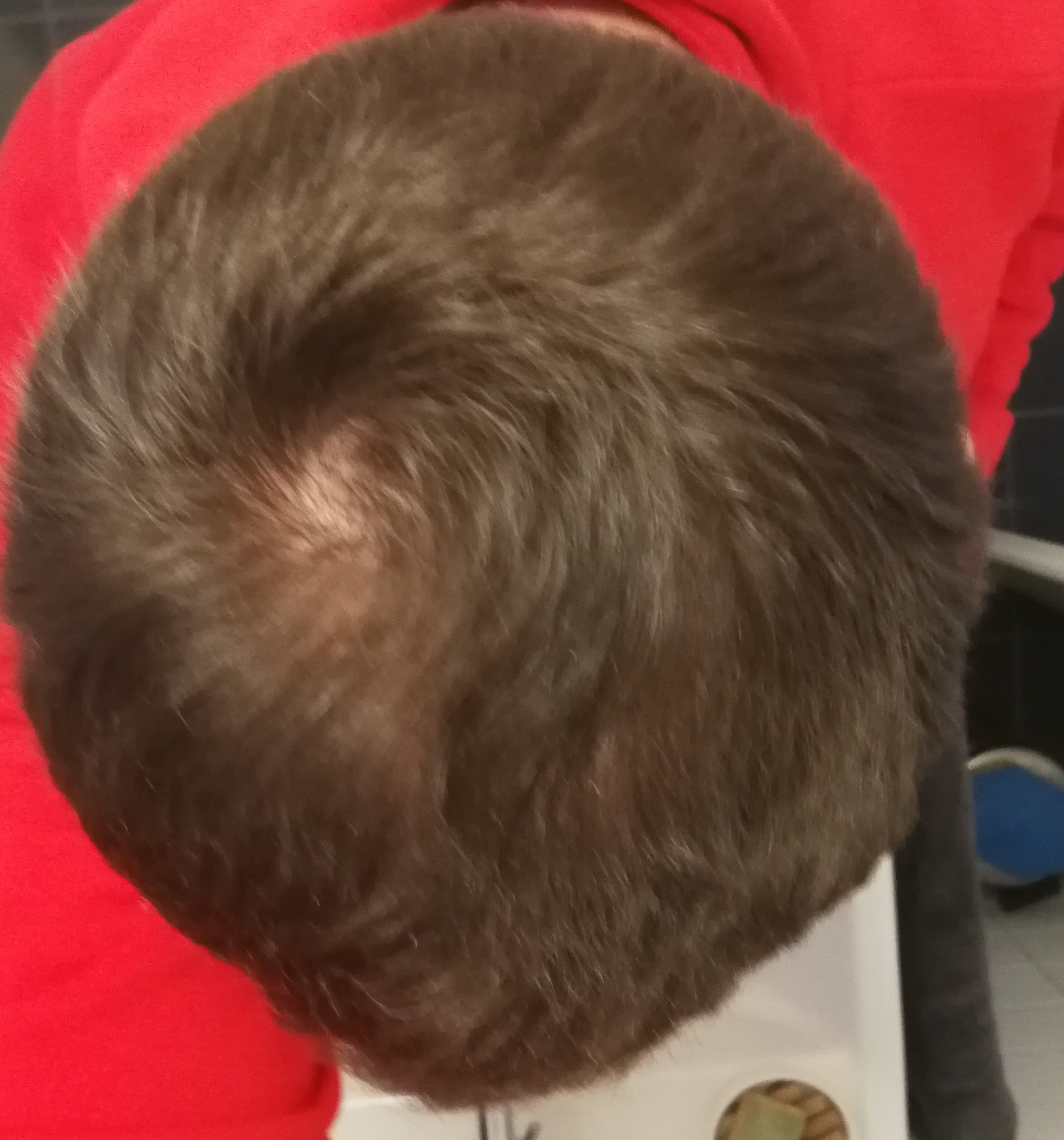 /foren/transplant/index.php?t=getfile&id=44871&private=0