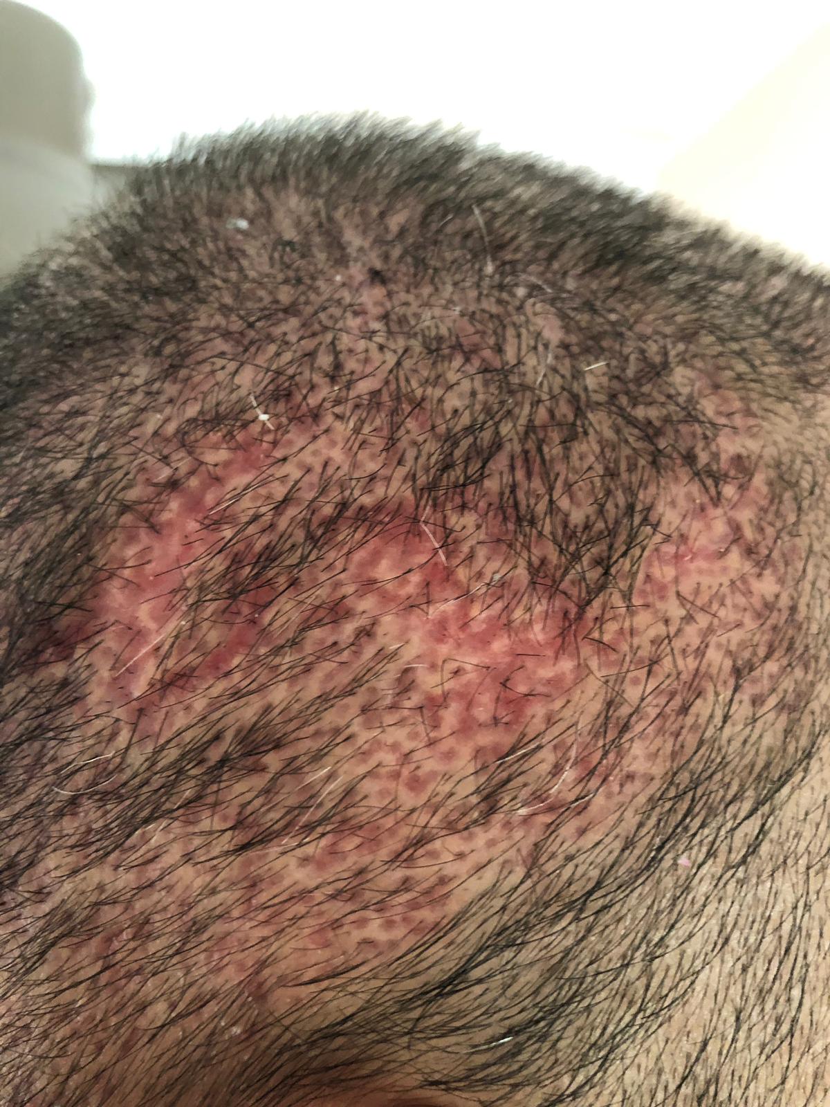 /foren/transplant/index.php?t=getfile&id=44872&private=0