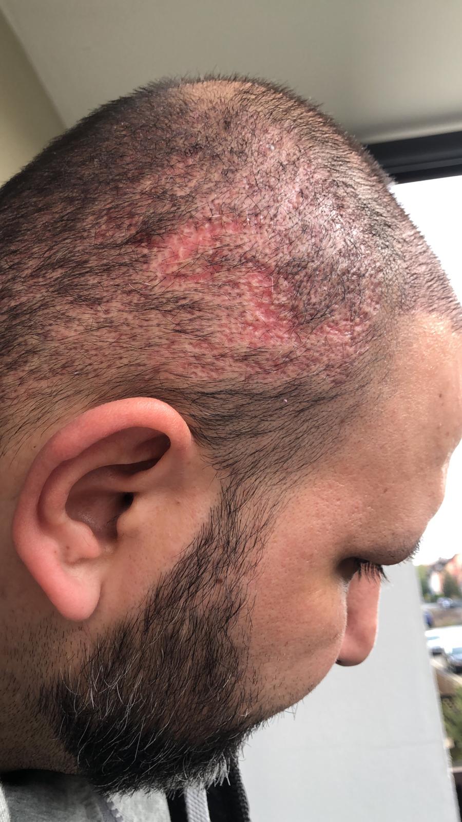 /foren/transplant/index.php?t=getfile&id=44873&private=0