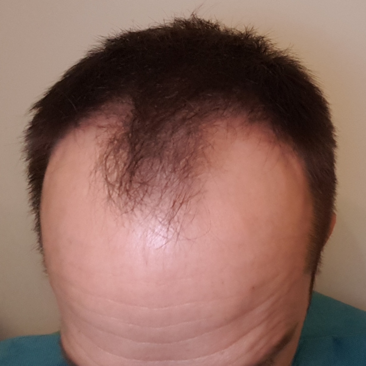 /foren/transplant/index.php?t=getfile&id=44953&private=0