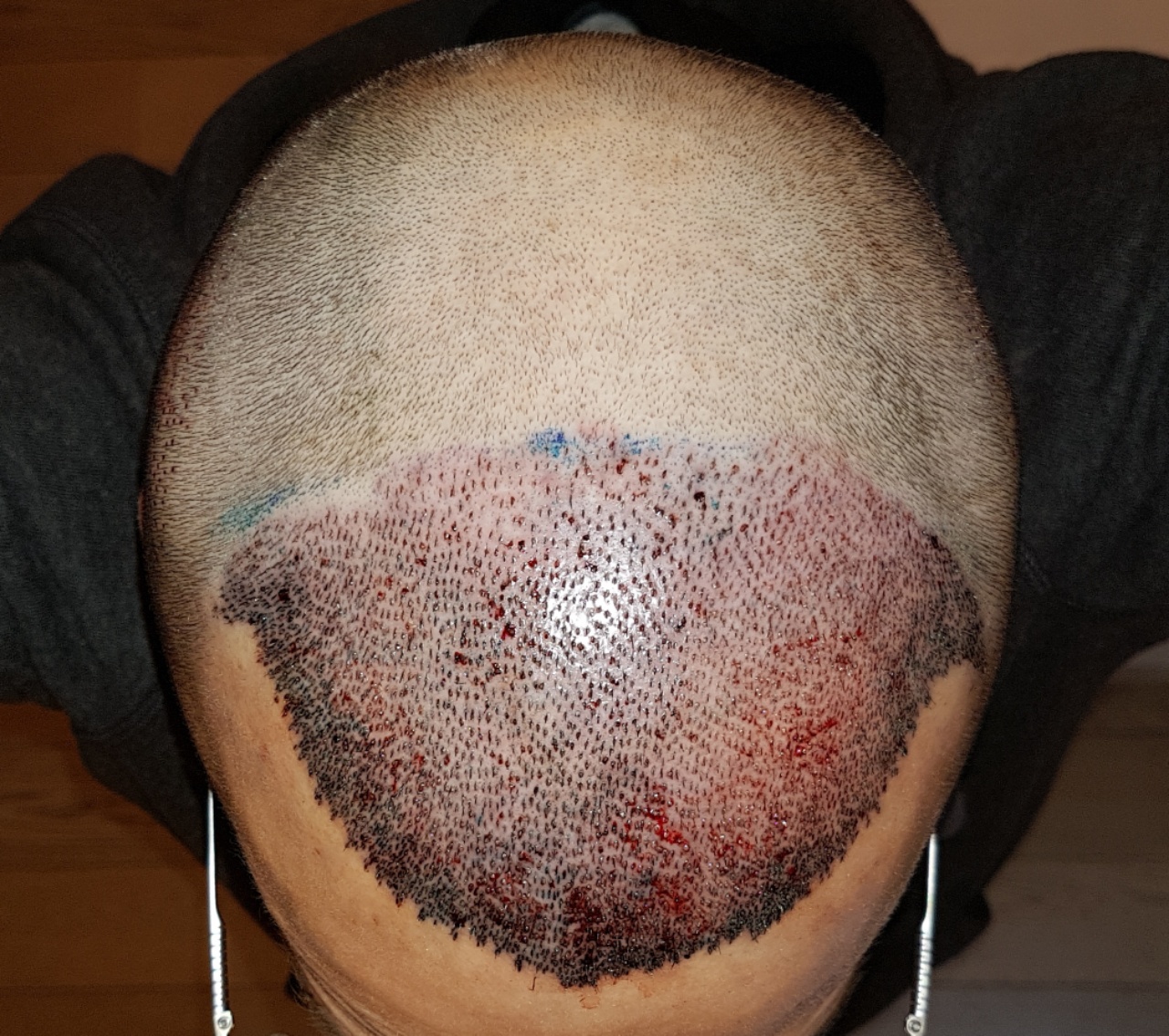 /foren/transplant/index.php?t=getfile&id=44956&private=0