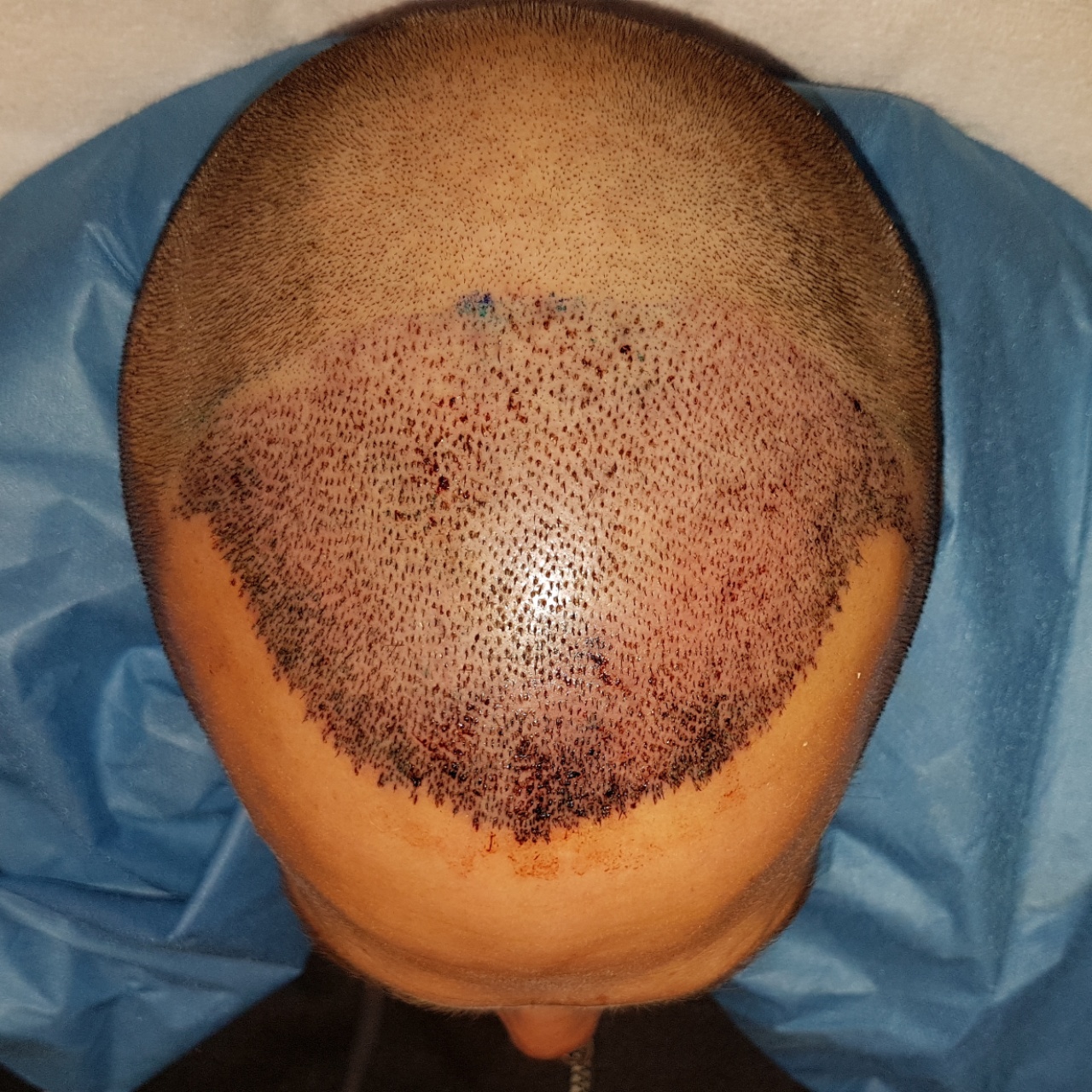 /foren/transplant/index.php?t=getfile&id=44958&private=0