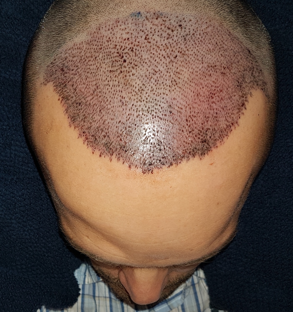 /foren/transplant/index.php?t=getfile&id=44959&private=0