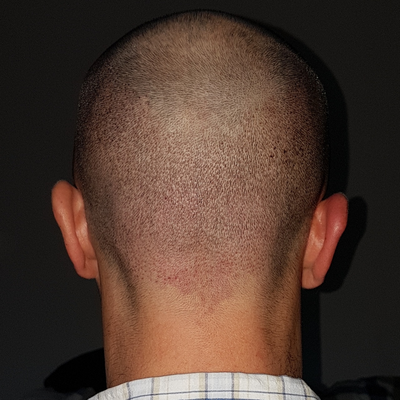 /foren/transplant/index.php?t=getfile&id=44960&private=0