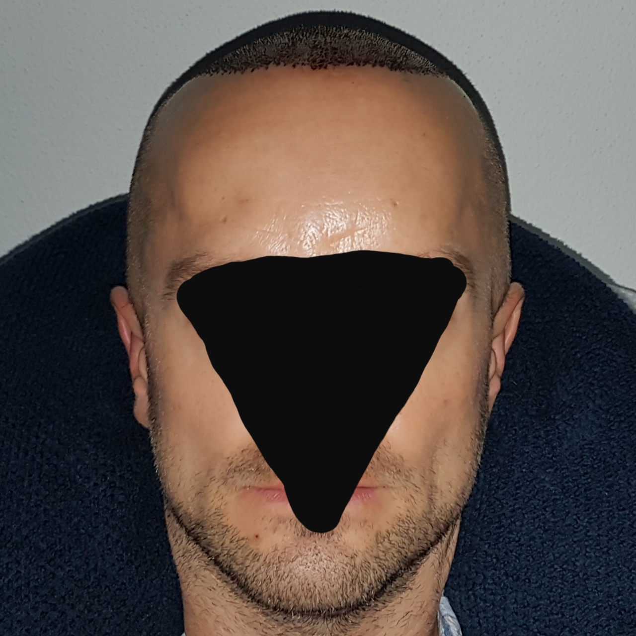 /foren/transplant/index.php?t=getfile&id=44961&private=0