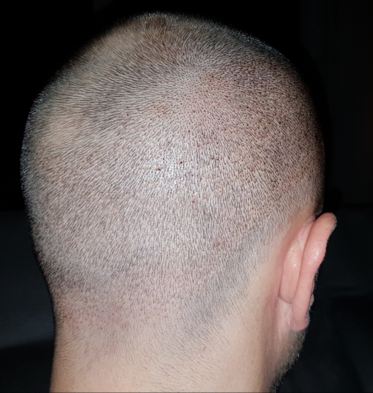 /foren/transplant/index.php?t=getfile&id=44962&private=0