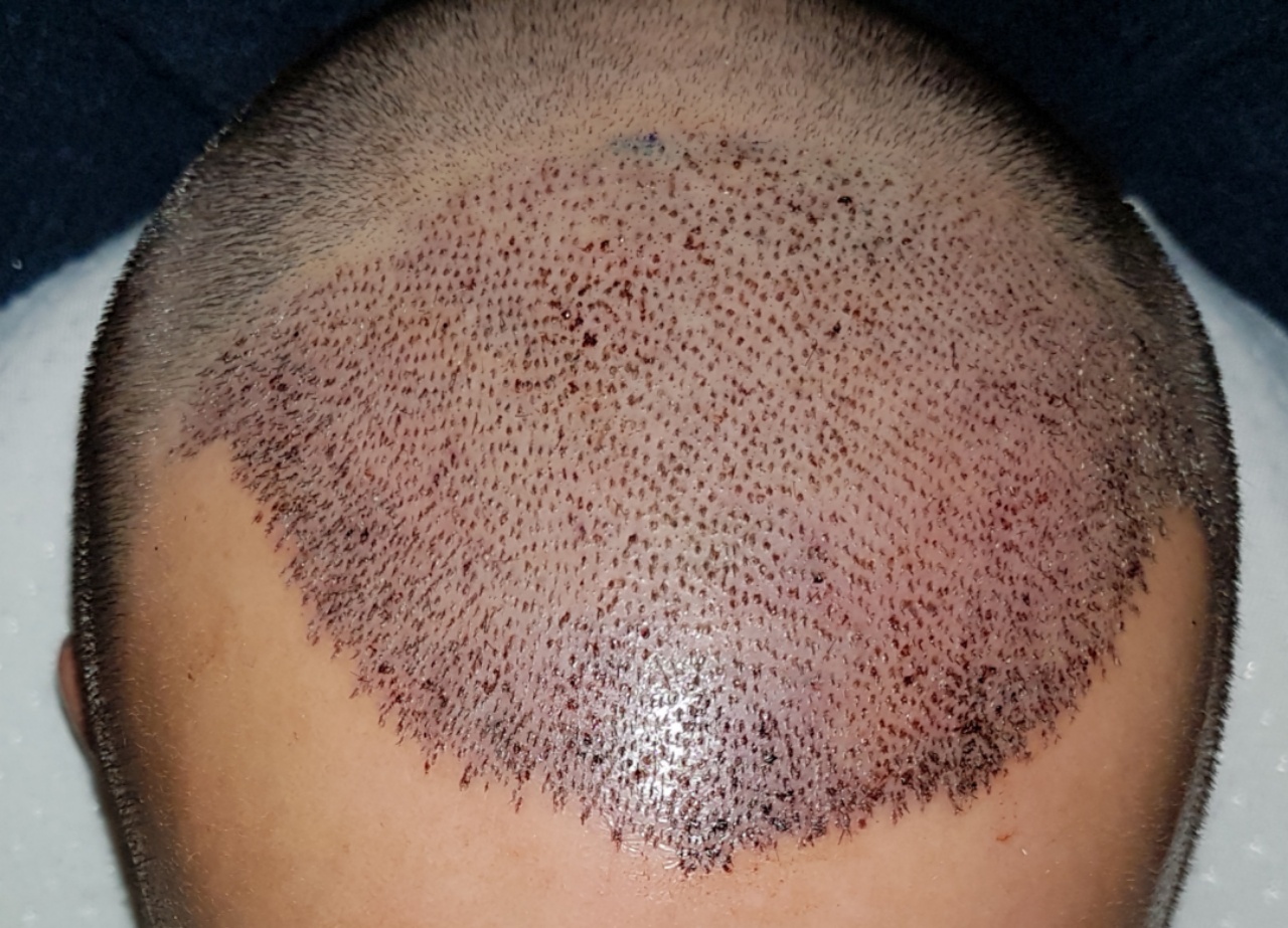 /foren/transplant/index.php?t=getfile&id=44963&private=0