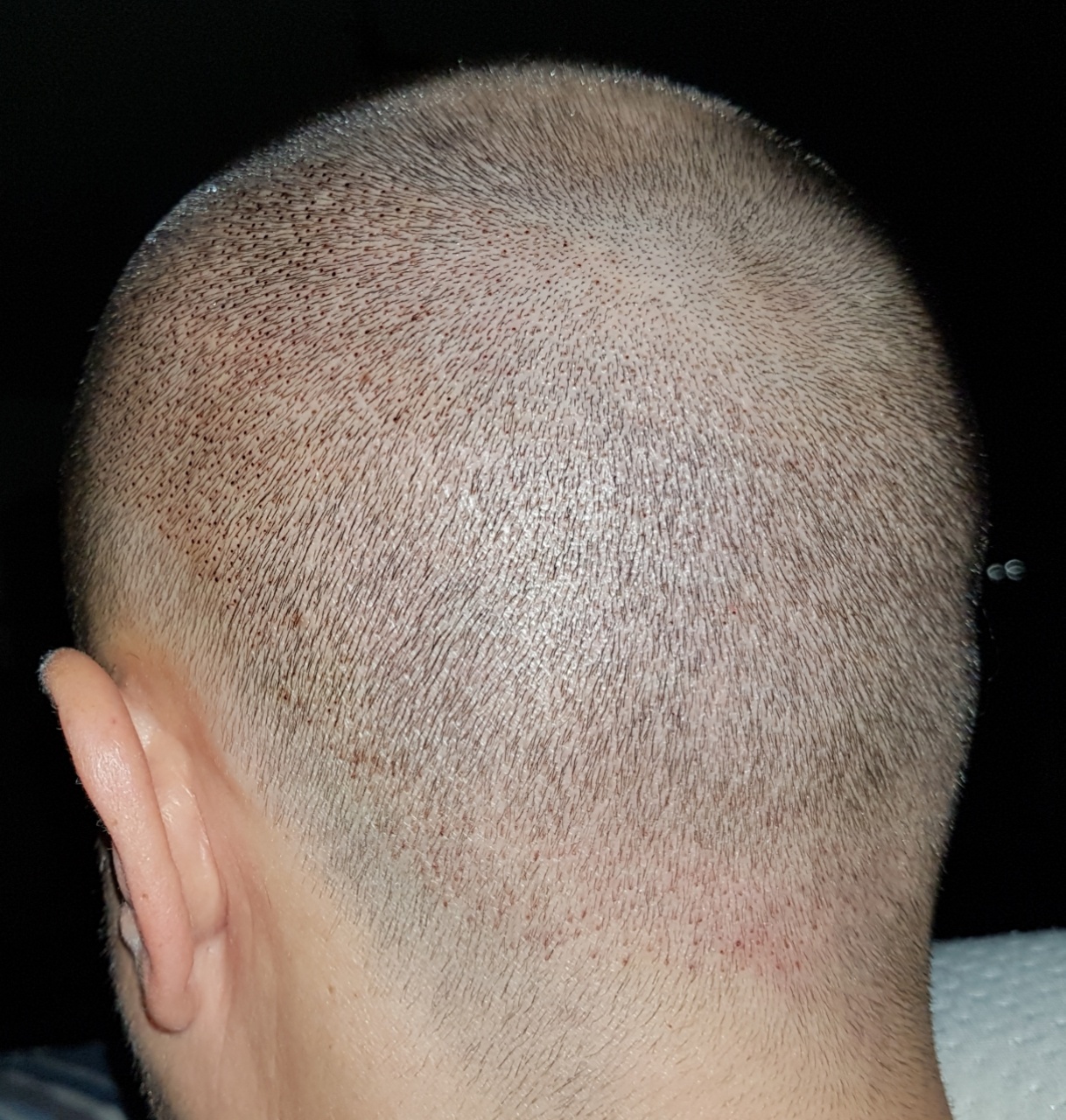 /foren/transplant/index.php?t=getfile&id=44964&private=0