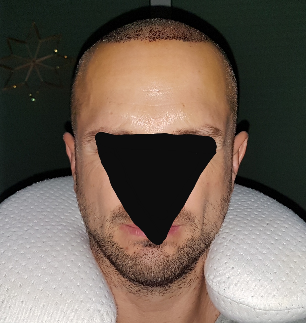 /foren/transplant/index.php?t=getfile&id=44965&private=0