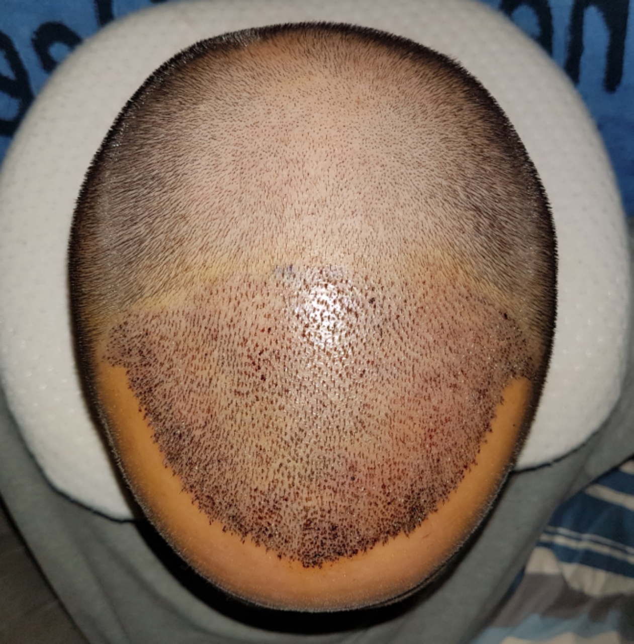 /foren/transplant/index.php?t=getfile&id=44966&private=0