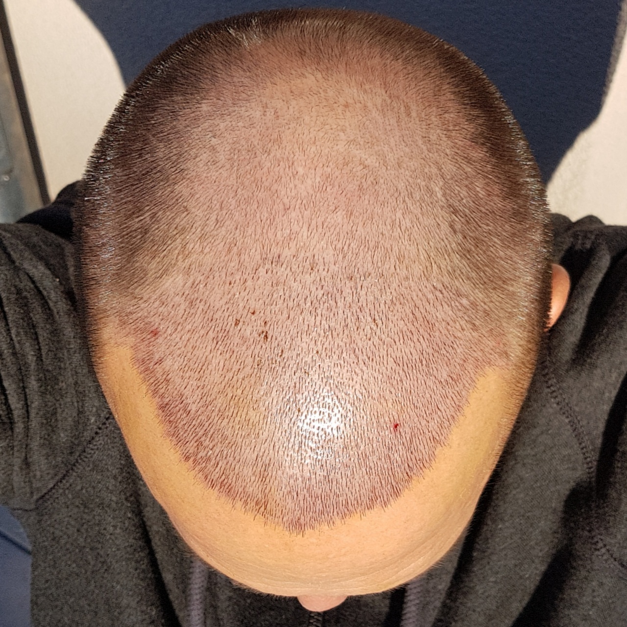 /foren/transplant/index.php?t=getfile&id=44968&private=0