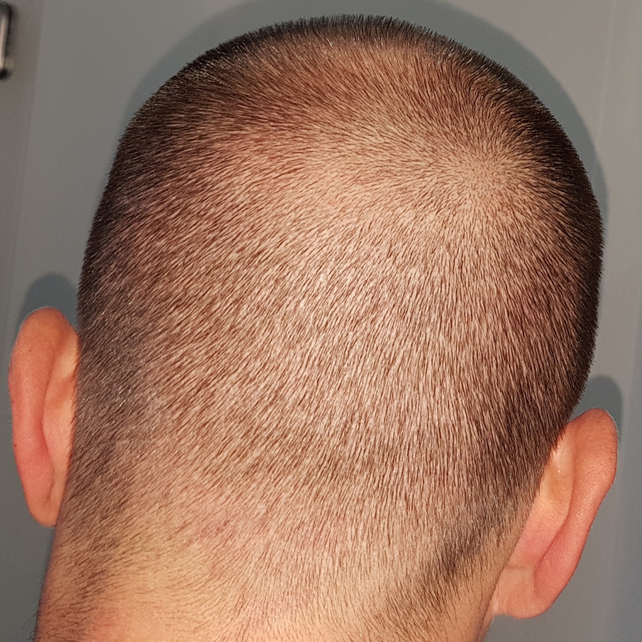 /foren/transplant/index.php?t=getfile&id=44969&private=0