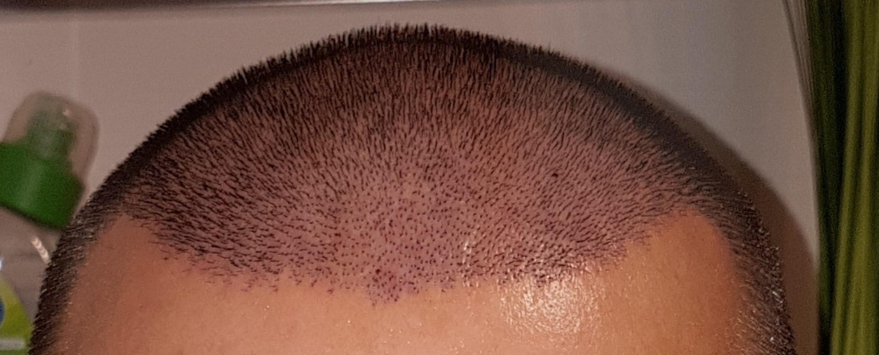 /foren/transplant/index.php?t=getfile&id=44975&private=0