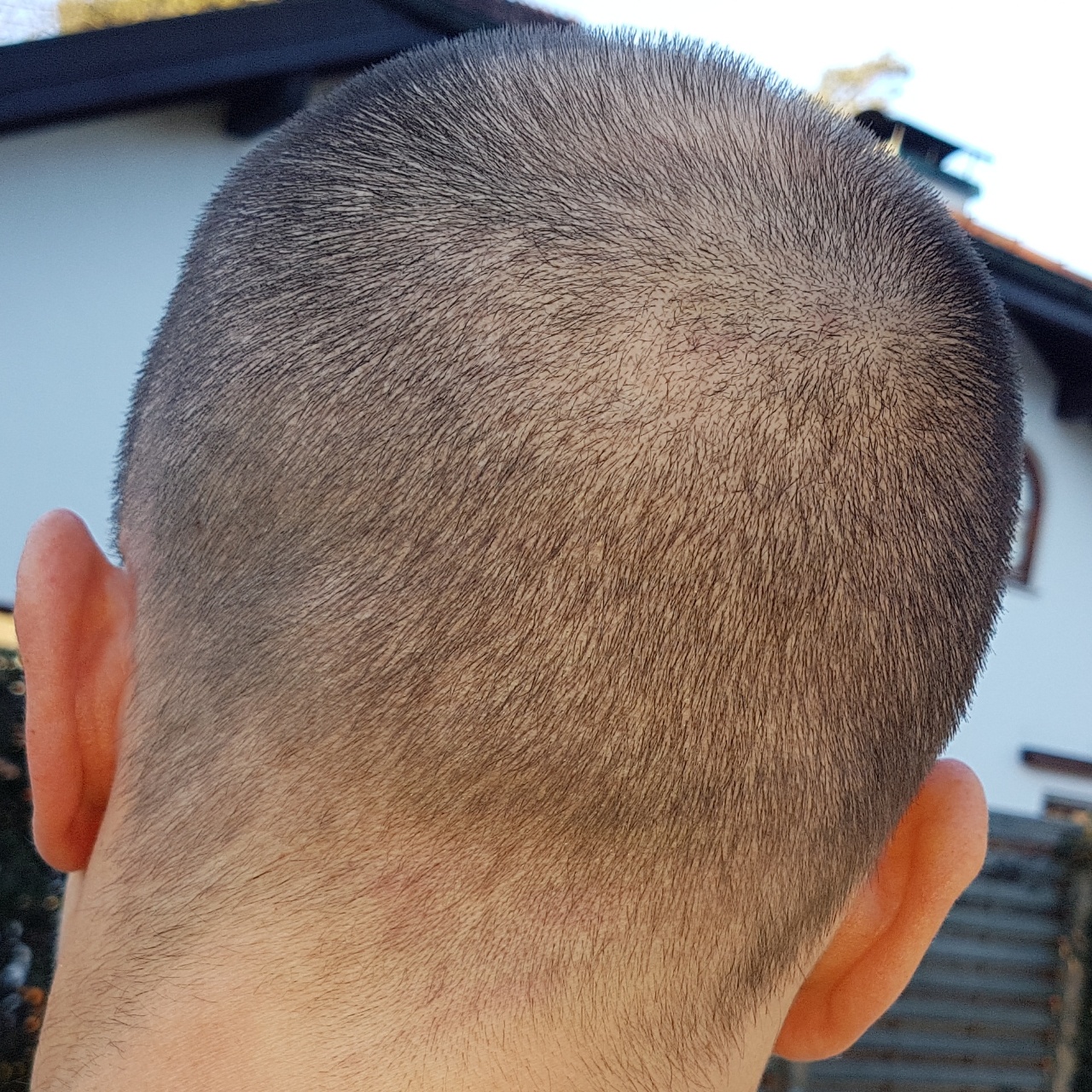 /foren/transplant/index.php?t=getfile&id=44977&private=0